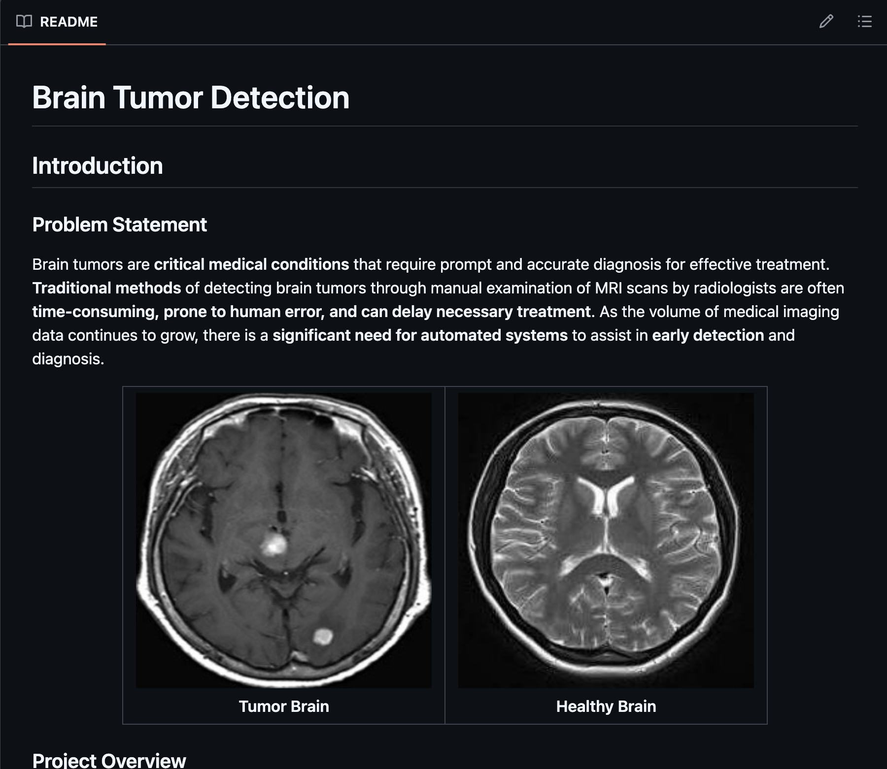 Brain Tumor Detection